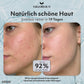 Hypochlorige Säure