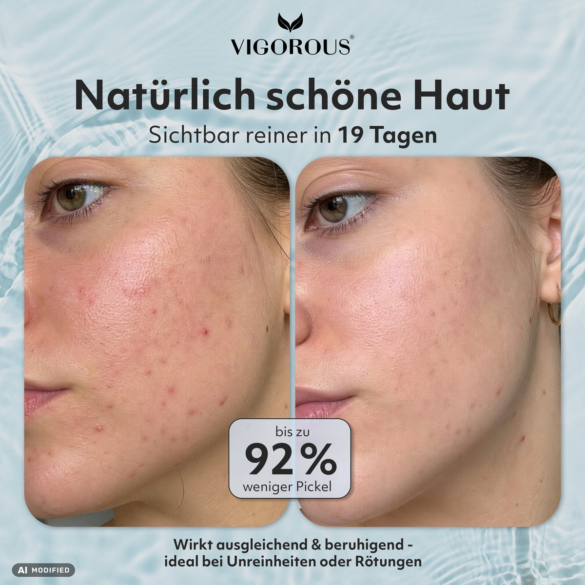 Hypochlorige Säure