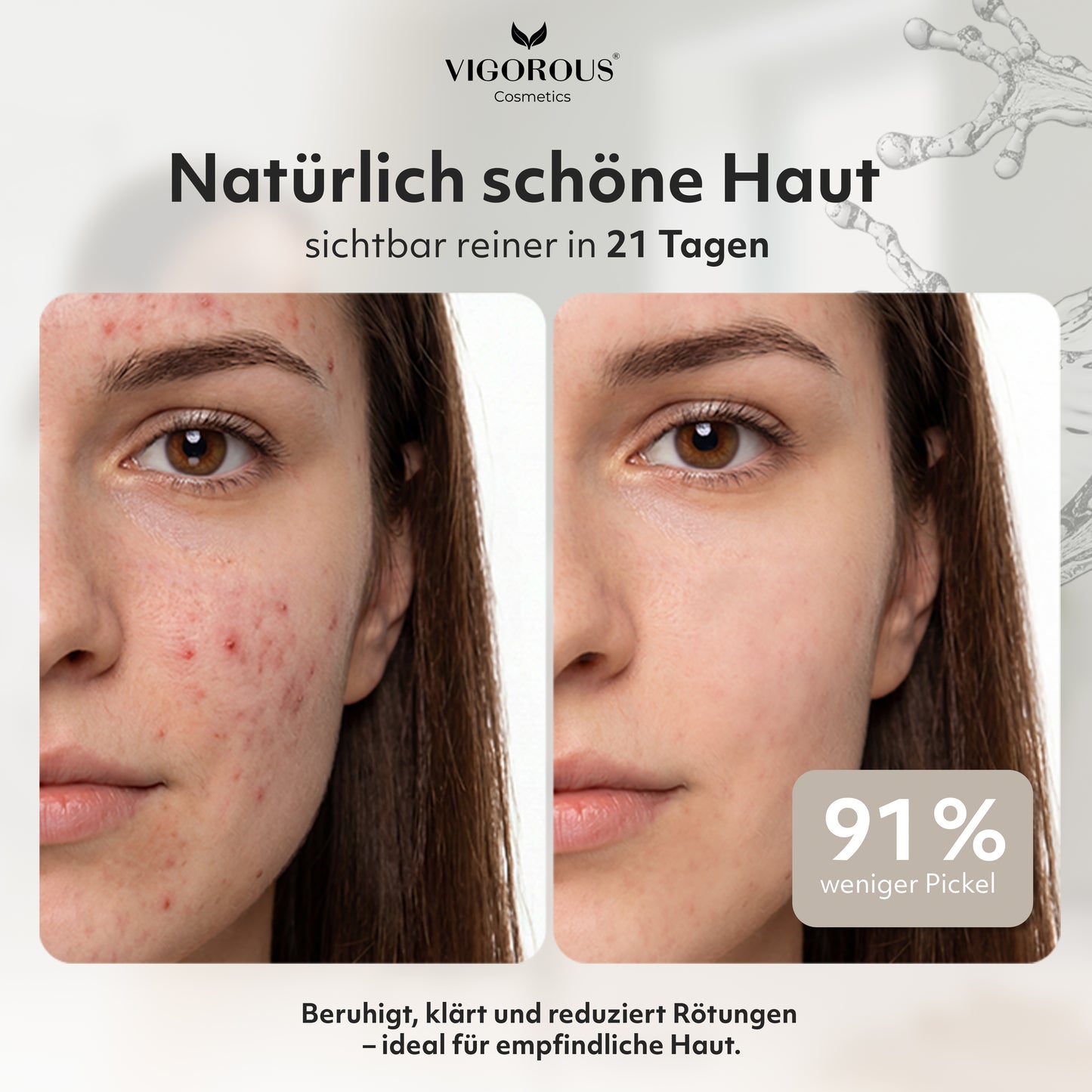 Zinkwasser gegen Pickel