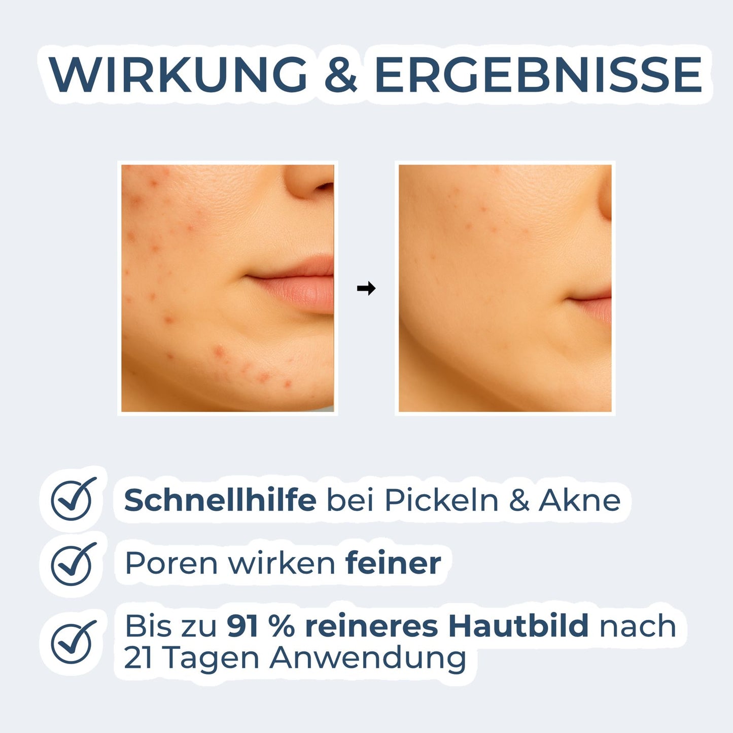 Zinkwasser gegen Pickel